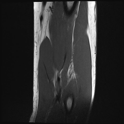 Click on the Serie image to view the images of Wieszt, Gnter